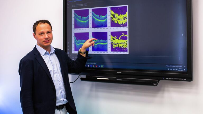 Найден способ определять неврологические болезни по сетчатке глаза