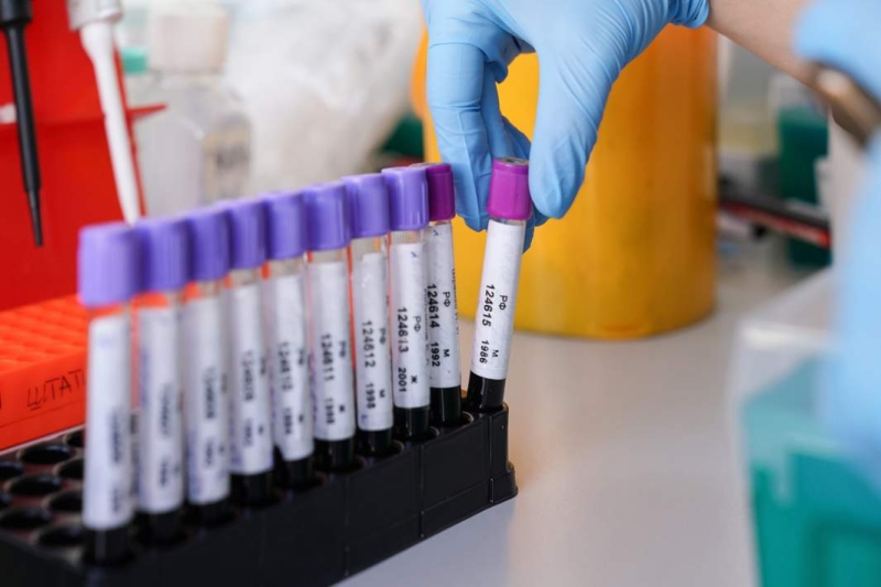 Без лишних движений: можно ли похудеть при помощи силы мысли